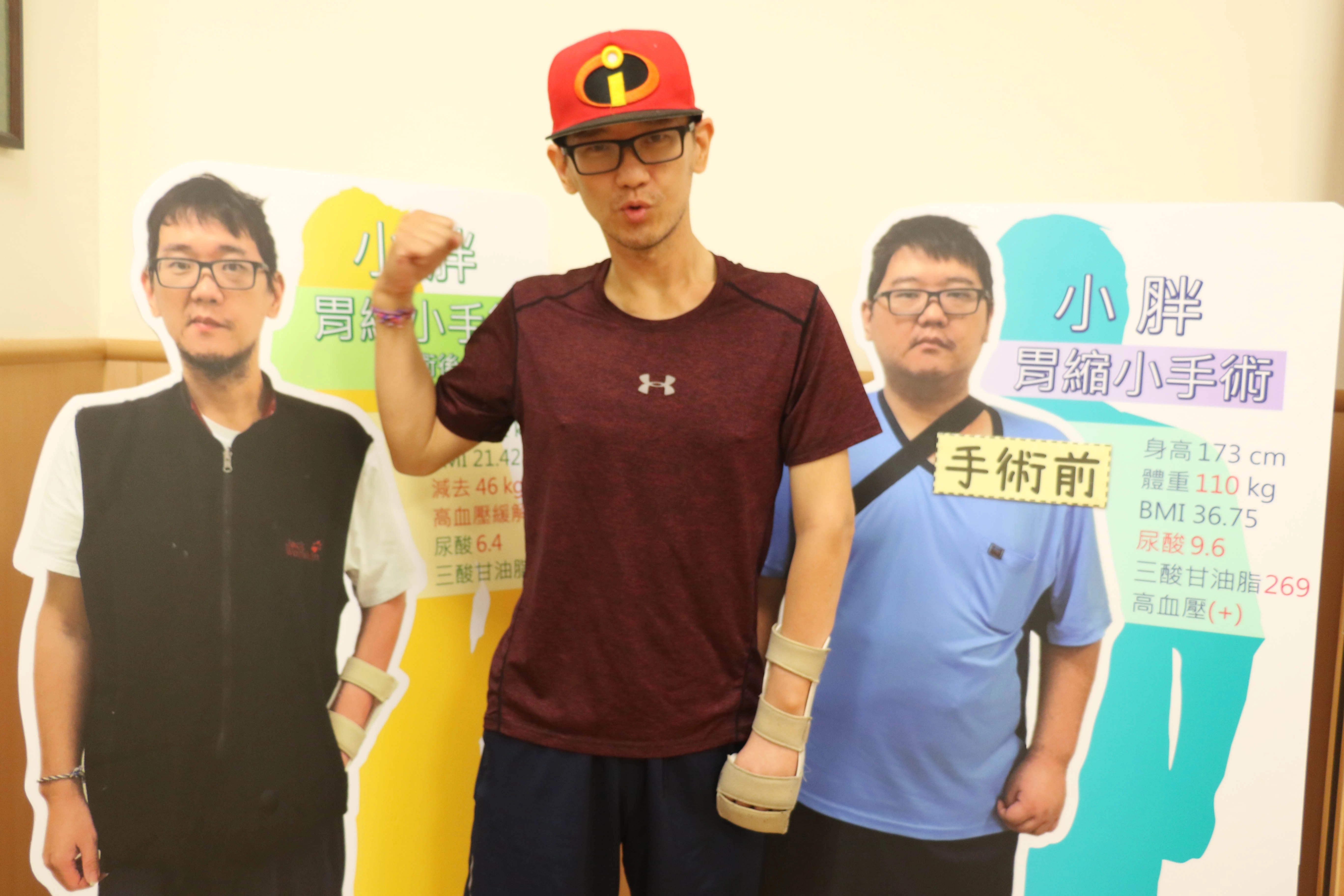跟減重手術前相較,林先生瘦了四十多公斤並持續運動。