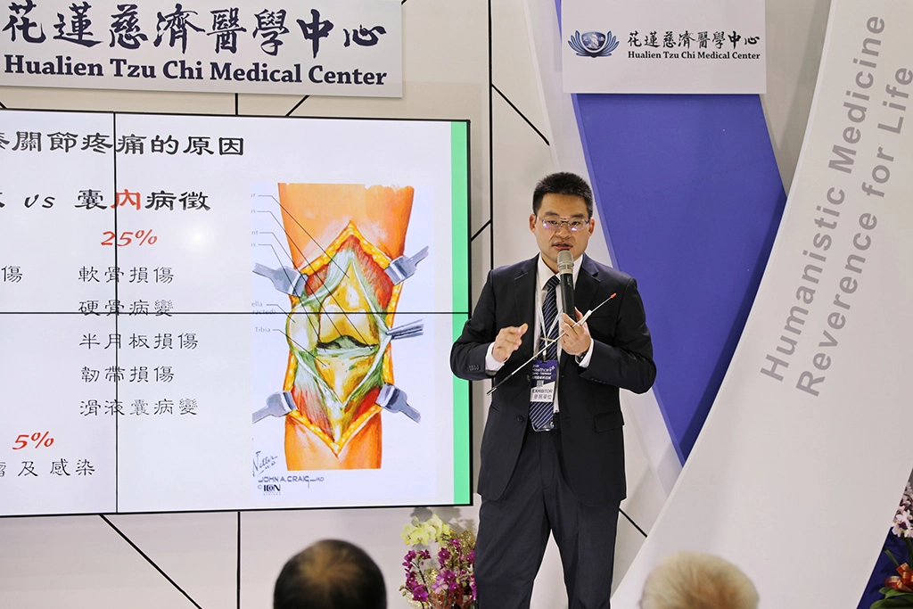 花蓮慈院運動醫學中心劉冠麟醫師進一步指出,在保守療法無效之後,除了吃藥之外,細胞療法是一個替代的選擇,目前,經由醫師仔細的評估病灶位置,檢查力線是否正確、排除關節內物理性壓迫的病兆後,即可考慮細胞治療。