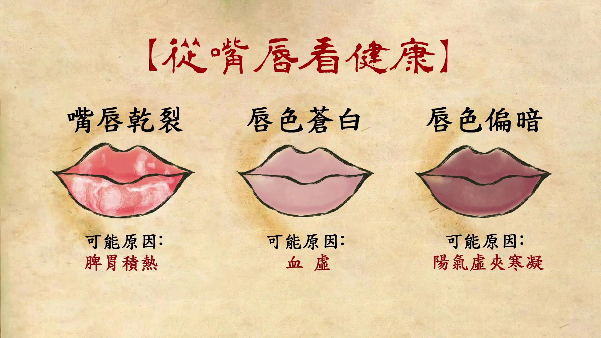 嘴唇脫皮還有發炎現象,就表示脾胃積熱。