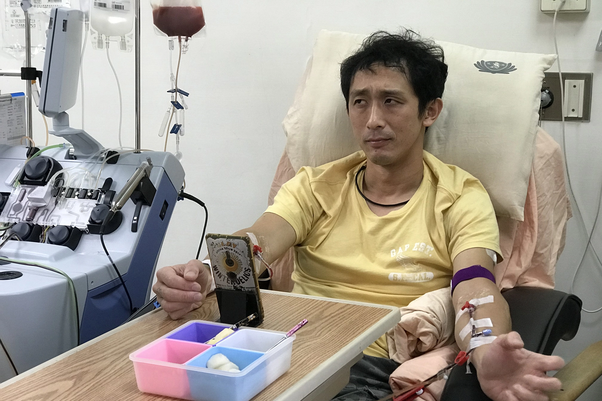 蔡豐燦以「採集周邊血收集造血幹細胞」為捐贈方式,當這次再度扎針時,他很清楚知道再次走進醫院不是為了自己,而是要救另一個人。