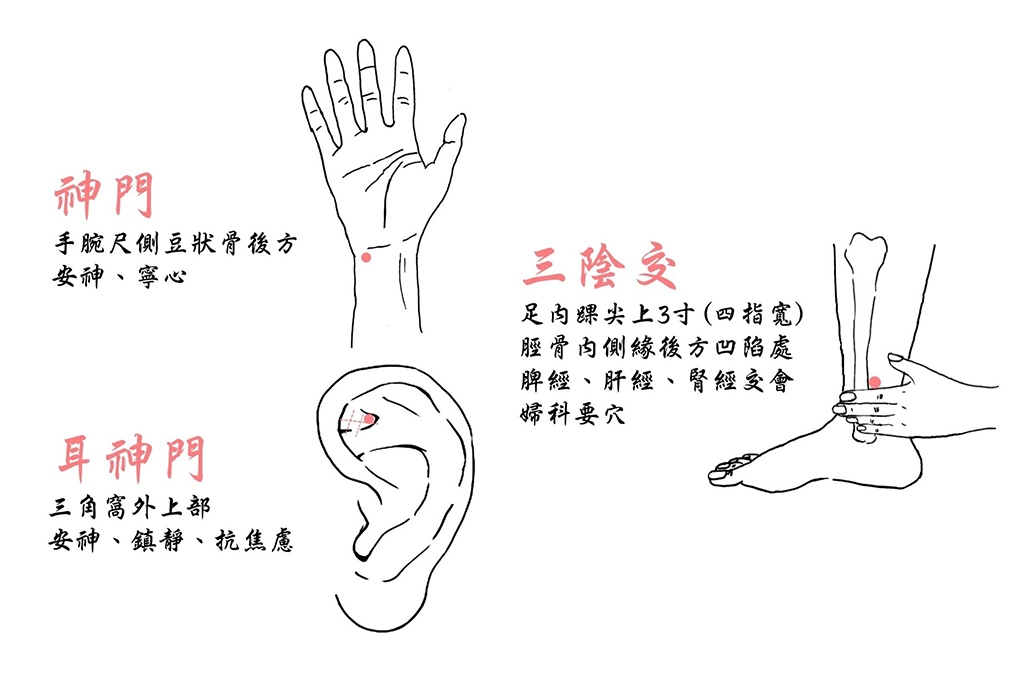 按壓三陰交、神門、耳神門等穴位,有助改善更年期生活品質。