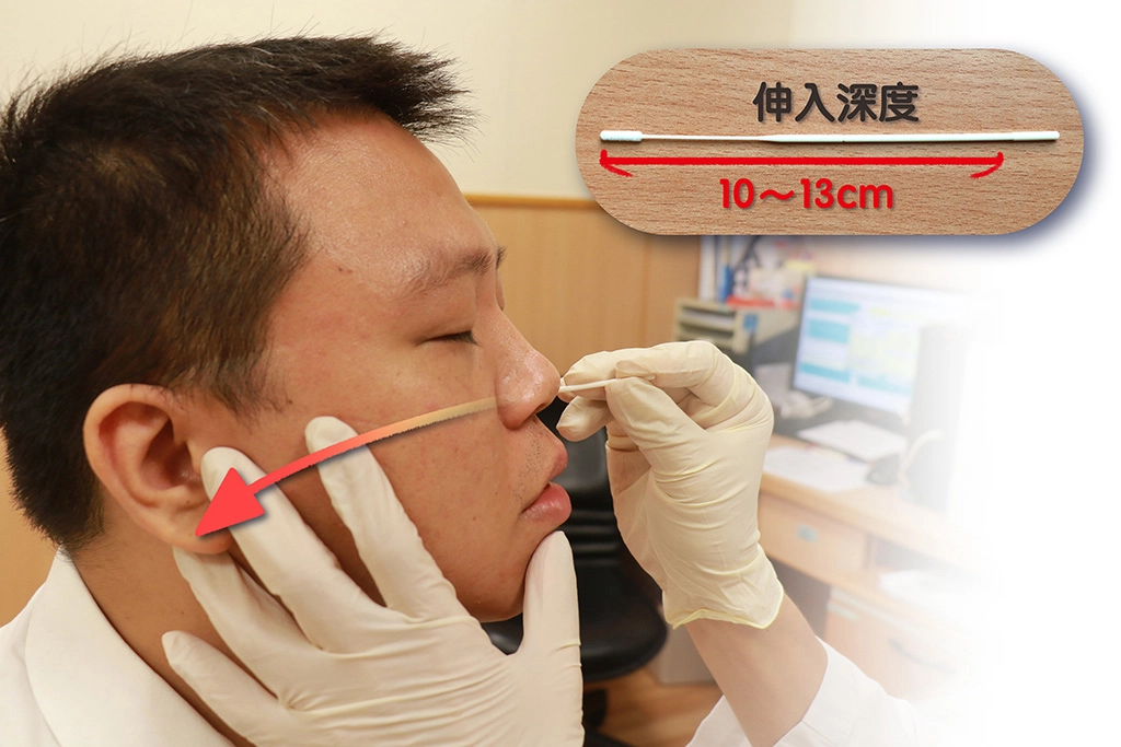 長柄快篩棒成人深入長度約十到十三公分到達鼻咽處。