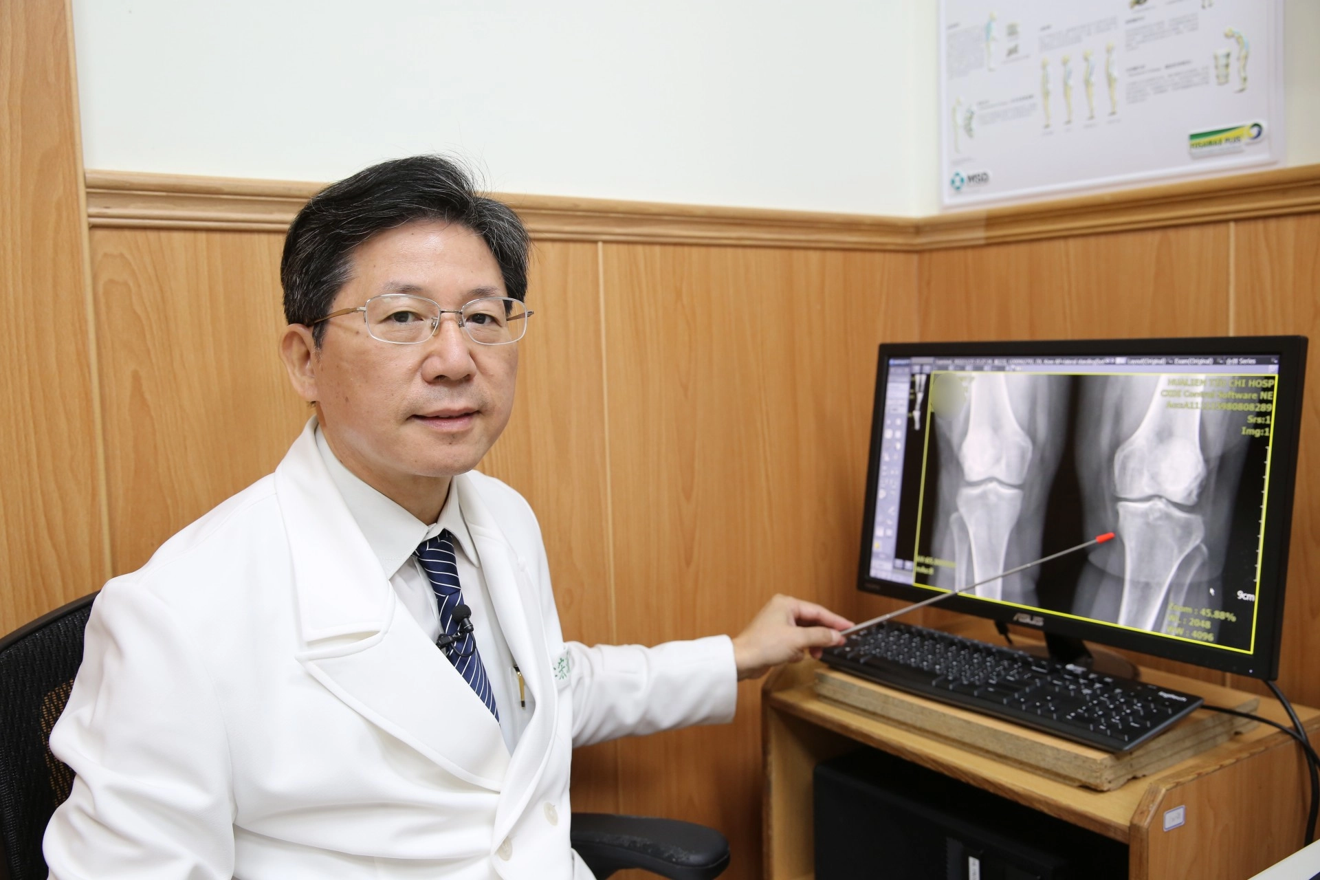 花蓮慈濟醫院總顧問暨骨科醫師李宏滿教授使用自體骨髓間質幹細胞治療葉女士的退化性膝關節炎,經追蹤一年後,她的左膝疼痛,獲得大幅度的改善。