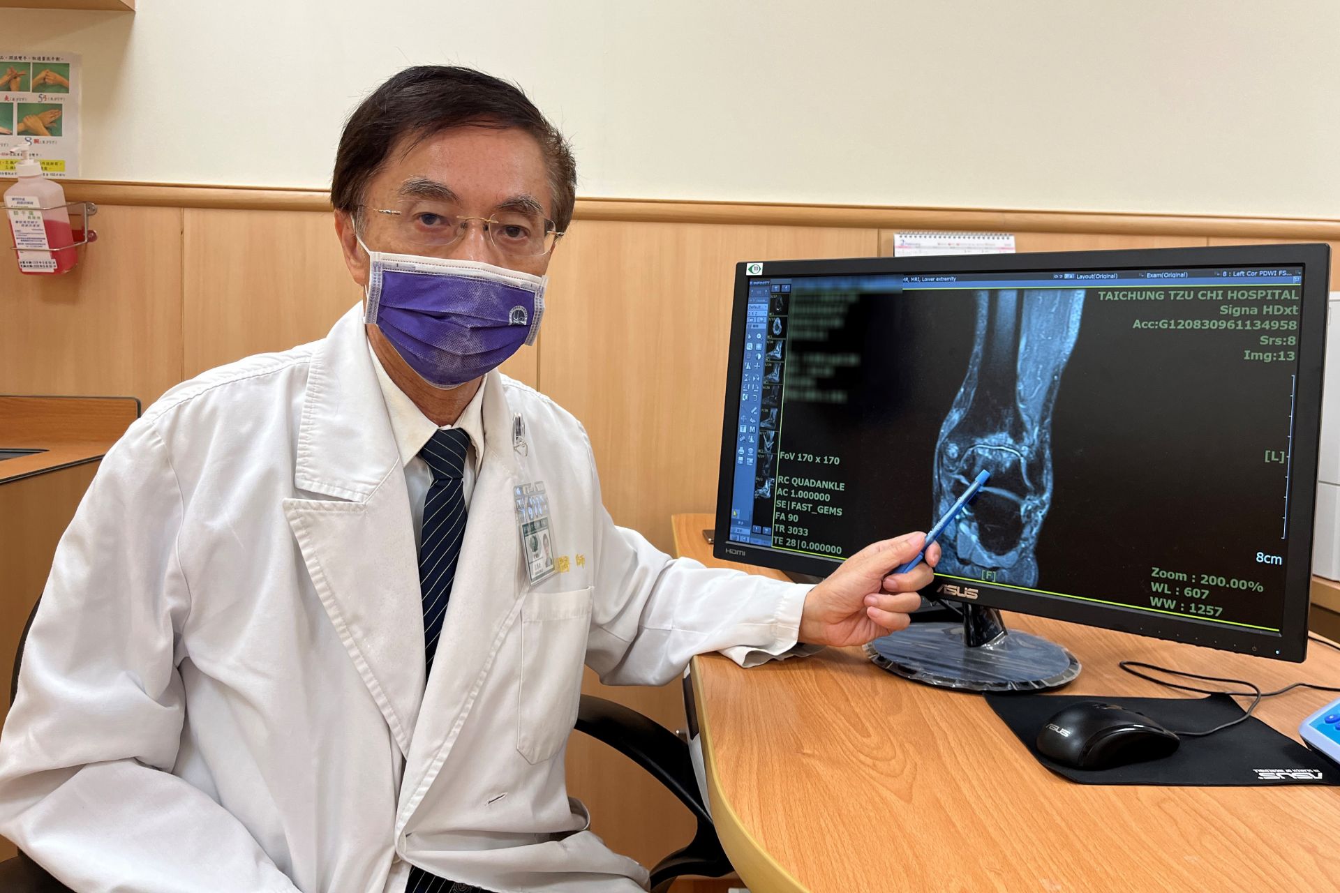 呂傳欽醫師指出病人核磁共振影像上,可見左踝關節的關節腔狹窄,且關節兩端骨頭有骨質水腫現象。