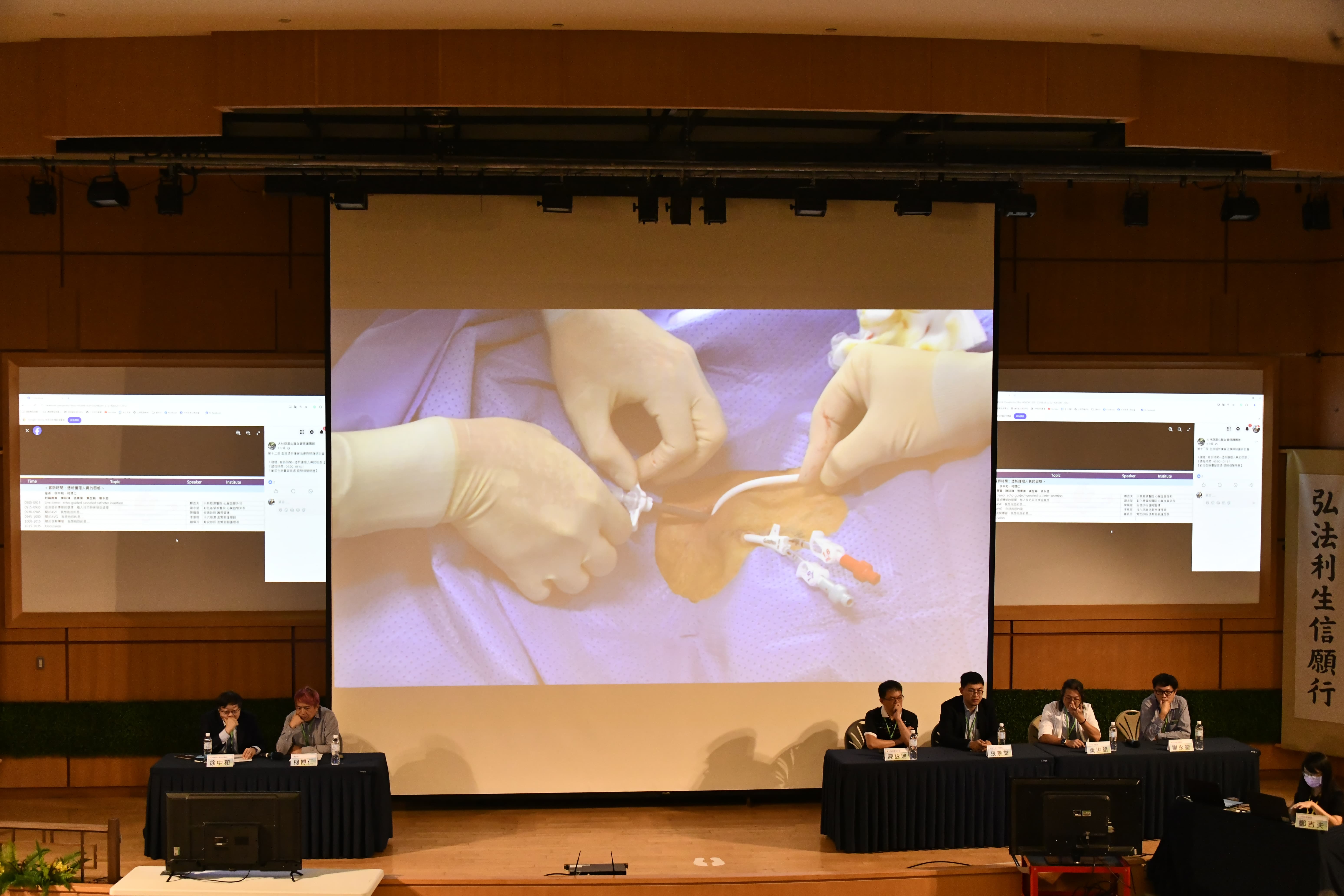 現場手術室視訊連線Live即時轉播中，首先由大林慈濟醫院心臟血管外科鄭吉夫醫師