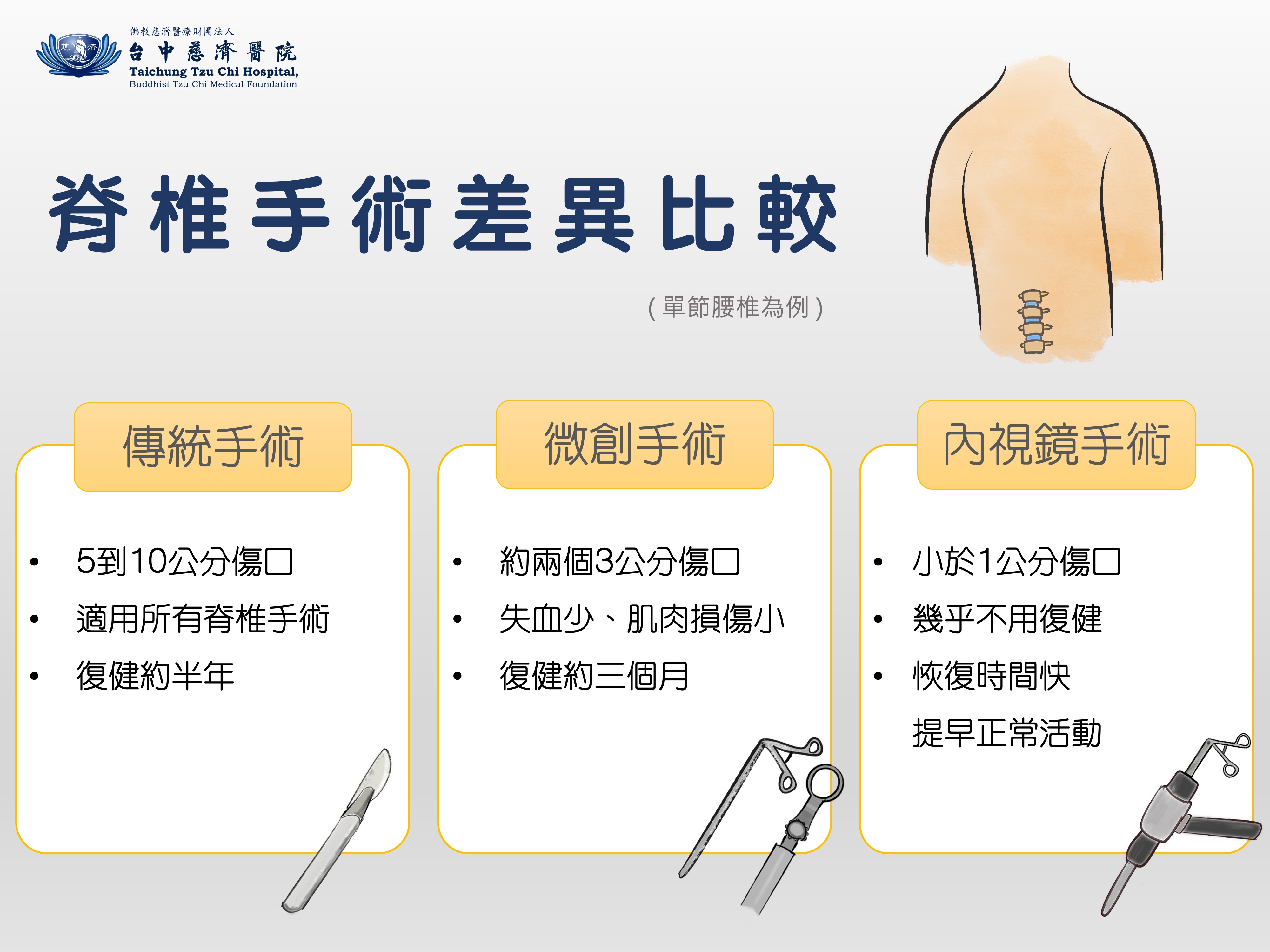 脊椎手術差異比較