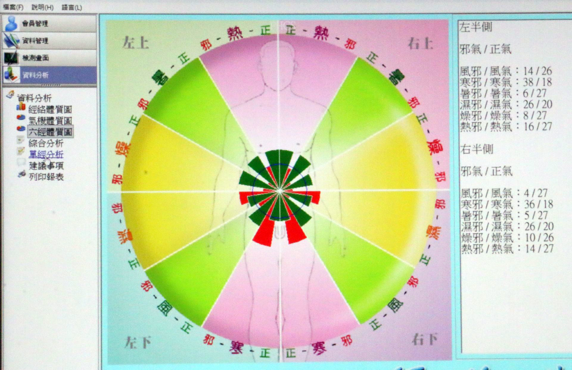 經絡能量檢測儀量測結束後,會產生一張能量圖,讓民眾參考。