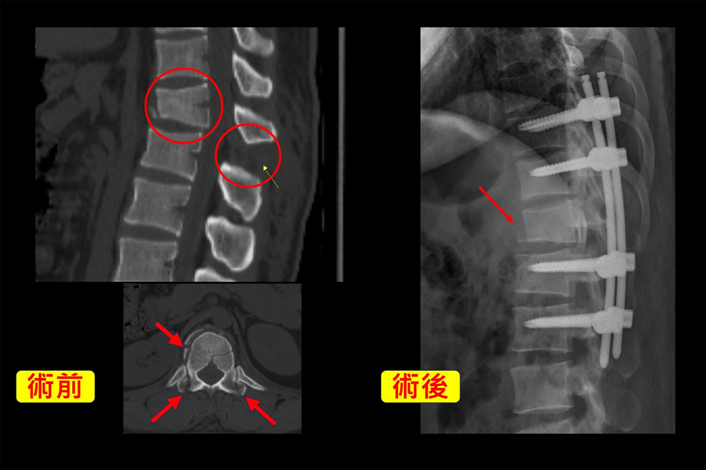 術前與術後醫學影像對比。