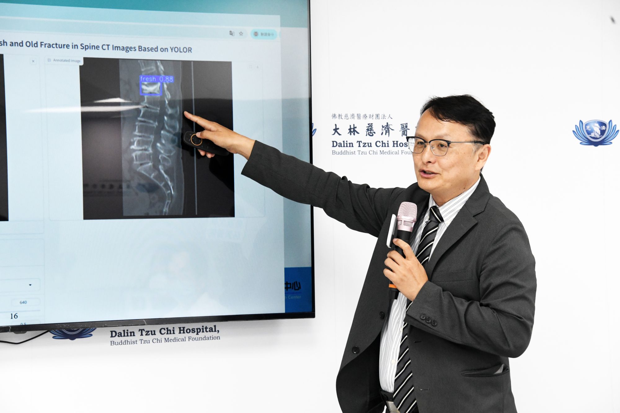 雲科大校長張傳育表示,骨科團隊與雲科大合作的AI系統,不僅補足CT影像診斷的限制,更能在第一線提供醫師精準判斷依據,協助患者早期治療、避免後續併發症,成果有意義,令人感到振奮。