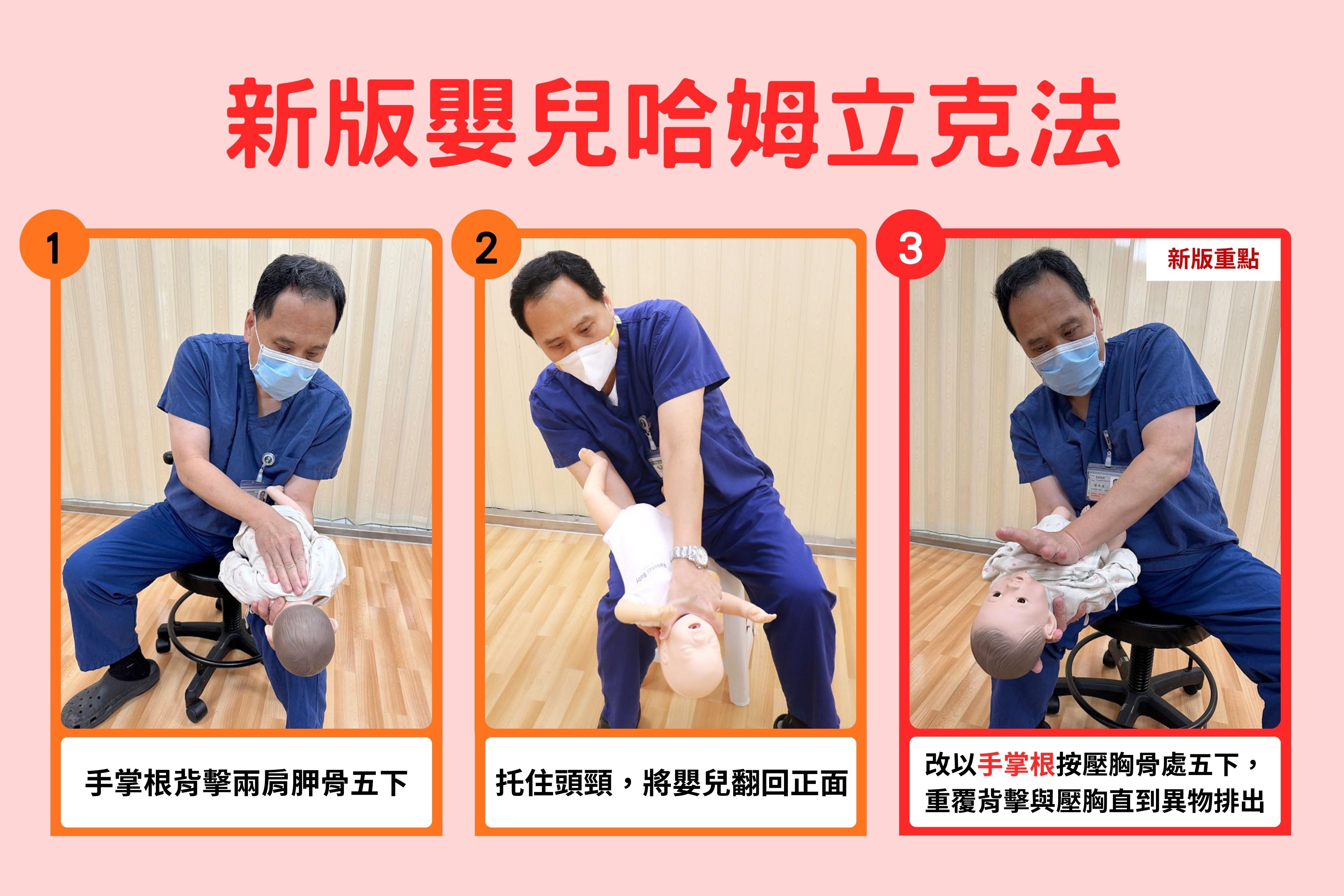 新版嬰兒哈姆立克法,從「雙指按壓」調整為「單手掌根推胸」。