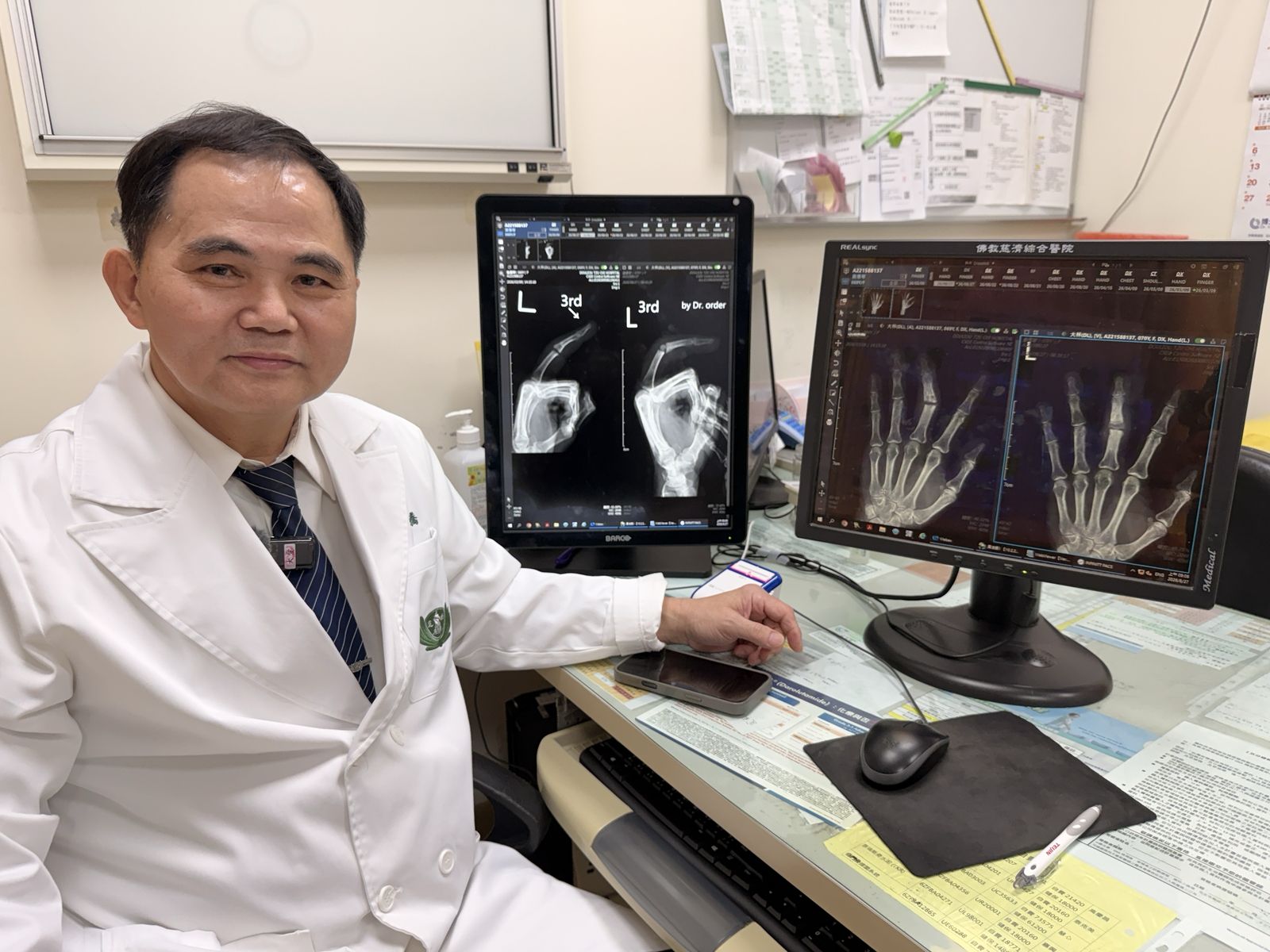 斗六慈濟醫院簡瑞騰院長近期引進「指間人工關節」，並完成第一例手術